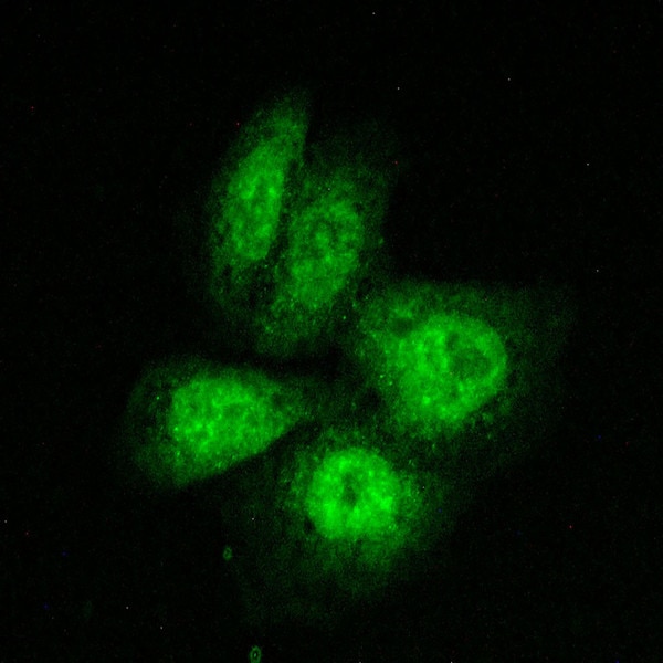 IF of A-431 cells labeled with DSHB antibody PCRP-HSF1-1A10 against HSF1; Heat shock transcription factor 1. Image credit: Soll Laboratory, University of Iowa. 